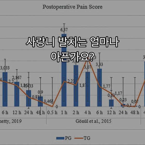사랑니 발치를 위한 잇몸 절개 디자인 도식