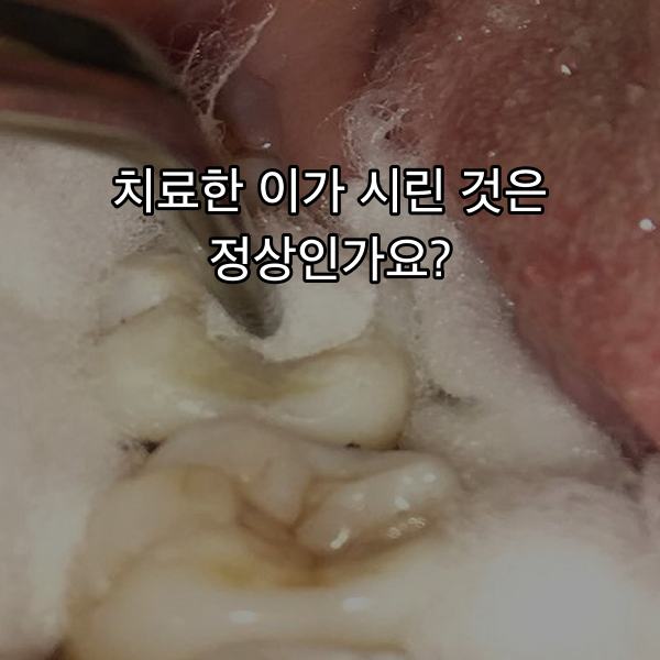 때운 어금니에 찬 자극을 대어 시림을 확인하는 임상 검사 장면