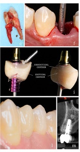 Changes of dental anxiety 논문 표제면