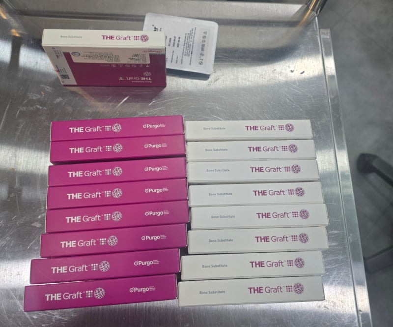 송파구치과 연세굿플란트치과 잠실송파본점 사례: 더 그라프트 인공뼈 재료