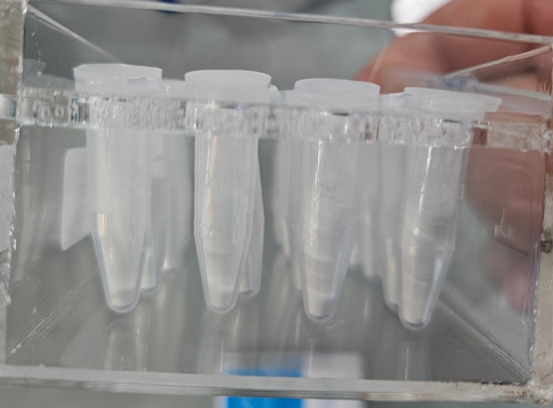 송파구치과 연세굿플란트치과 잠실송파본점 사례: Ortho MTA 신경관 충전 확인 사진 2